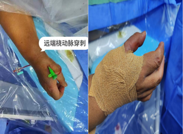 同仁医院挂号途径穿刺预约-同仁医院挂号途径穿刺预约怎么取消 同仁医院挂号途径穿刺预约-同仁医院挂号途径穿刺预约怎么取消